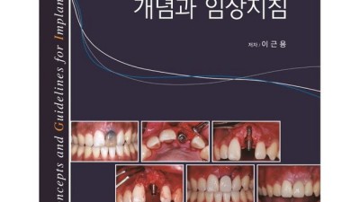 임플란트학 파헤치기🦷 솔직 후기 & 똑똑한 구매 꿀팁 대방출!